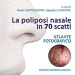 La poliposi nasale in 70 scatti. Atlante fotografico. Ediz. illustrata