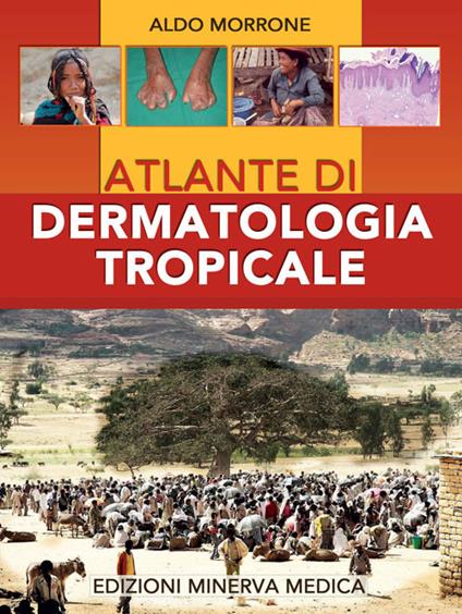 Atlante di dermatologia tropicale - Aldo Morrone - copertina