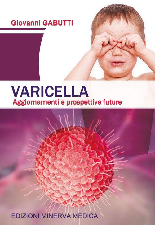 Varicella. Aggiornamenti e prospettive future - Giovanni Gabutti - copertina