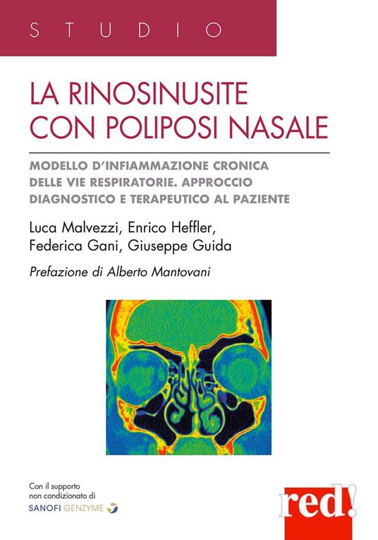 La rinosinusite con poliposi nasale. Modello d'infiammazione cronica delle vie respiratorie. Approccio terapeutico al paziente - Luca Malvezzi,Enrico Heffler,Federica Gani - copertina