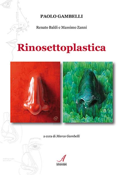 Rinosettoplastica - Paolo Gambelli,Renato Baldi,Massimo Zanni - copertina