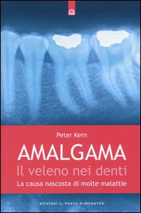 Amalgama. Il veleno nei denti. La causa nascosta di molte malattie - Peter Kern - copertina