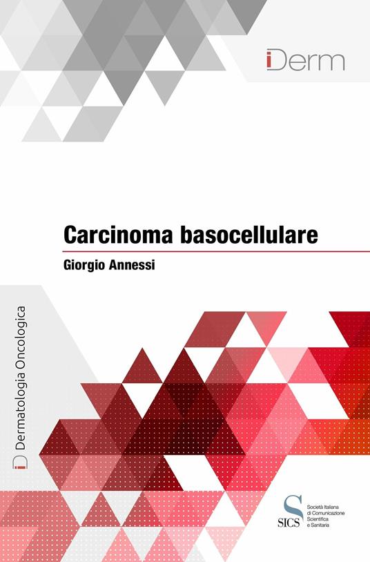 Carcinoma basocellulare - Giorgio Annessi - ebook