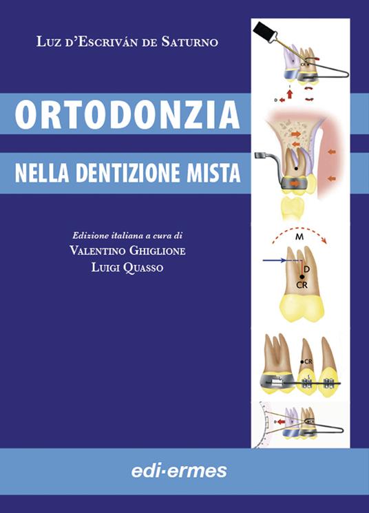 Ortodonzia nella dentizione mista - Luz D'Escriván De Saturno - copertina