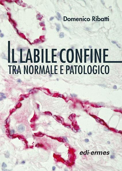 Il labile confine tra normale e patologico - Domenico Ribatti - copertina