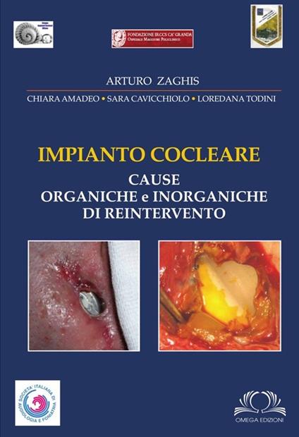 Impianto cocleare. Cause organiche e inorganiche di reintervento. Ediz. illustrata - Arturo Zaghis - copertina