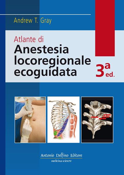 Atlante di anestesia locoregionale ecoguidata. Con Contenuto digitale per download e accesso on line - Andrew T. Gray - copertina