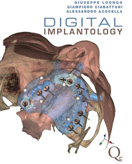 Digital implantology - Giuseppe Luongo,Giampiero Ciabattoni,Alessandro Acocella - copertina