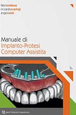 Manuale di implanto-Protesi computer assistita