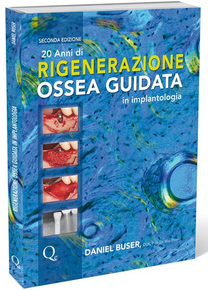 20 anni di rigenerazione ossea guidata in implantologia - Daniel Buser - copertina