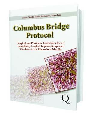 Columbus bridge protocol. Surgical and prosthetic guidelines for an immediately loaded, implant-supported prosthesis in the edentulous maxilla - Tiziano Tealdo,Marco Bevilacqua,Paolo Pera - copertina