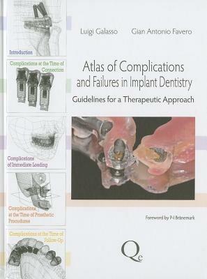 Atlas of complications and failures in implant dentistry. Guidelines for a therapeutic approach - Luigi Galasso,Gian Antonio Favero - copertina