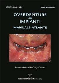 Overdenture su impianti. Manuale atlante - Adriano Dallari,Laura Rovatti - copertina