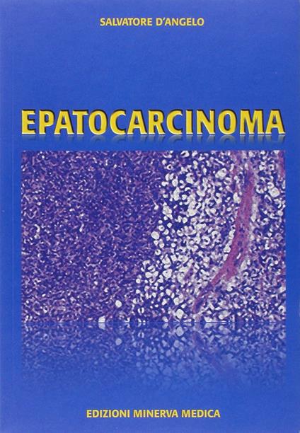 Epatocarcinoma - Salvatore D'Angelo,Paolo Sorrentino,Mario Secondulfo - copertina