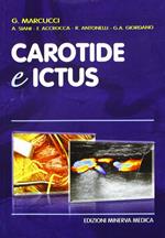 Carotide e ictus