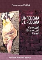 Linfedema e lipedema. Conoscerli. Riconoscerli. Curarli