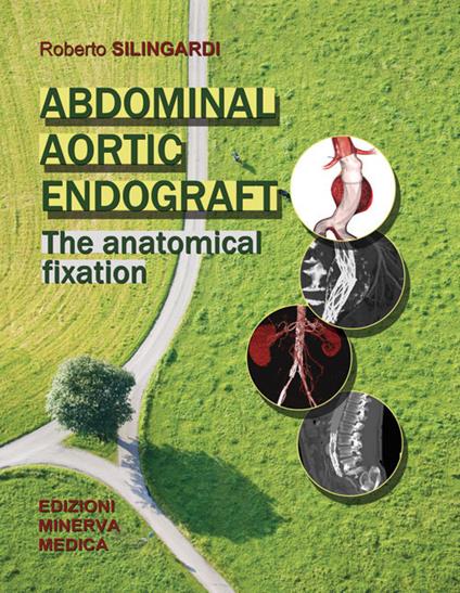 Abdominal aortic endograft. The anatomical fixation - Roberto Silingardi - copertina