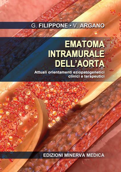 Ematoma intramurale dell'aorta. Attuali orientamenti eziopatogenetici clinici e terapeutici - Gianfranco Filippone,Vincenzo Argano - copertina