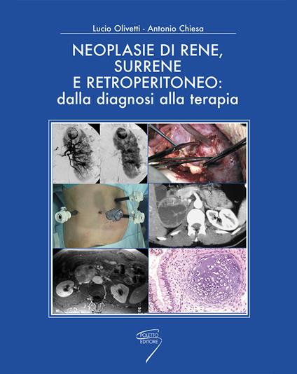 Neoplasie di rene, surrene e retroperitioneo: dalla diagnosi alla terapia - copertina