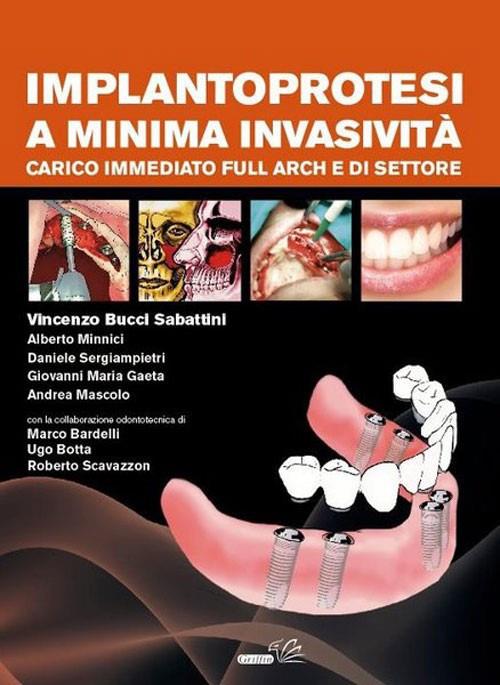 Implantoprotesi a minima invasività. Carico immediato full arch e di settore - Vincenzo Bucci Sabattini - copertina