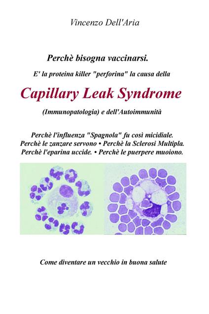 Perché bisogna vaccinarsi. È la proteina killer «perforina» la causa della Capillary Leach Syndrome (immunopatologia) e dell'autoimmunità - Vincenzo Dell'Aria - ebook