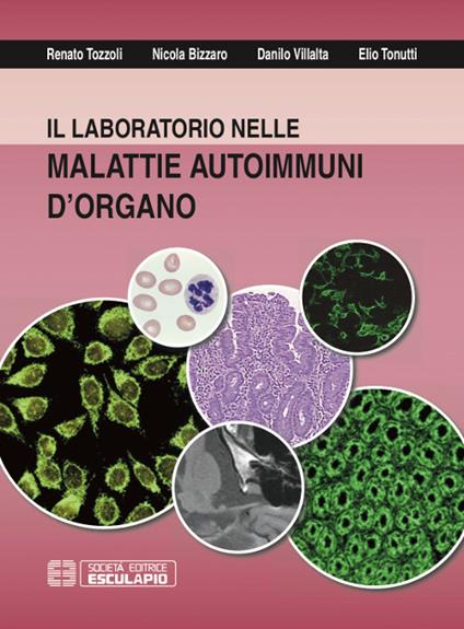 Il laboratorio nelle malattie autoimmuni d'organo - Renato Tozzoli,Nicola Bizzaro,Danilo Villalta - copertina