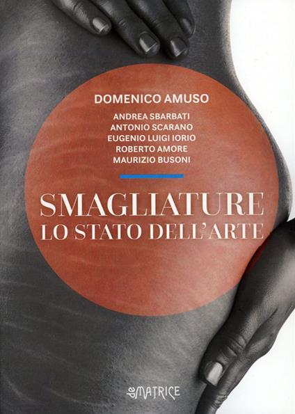 Smagliature. Lo stato dell'arte - Domenico Amuso - copertina