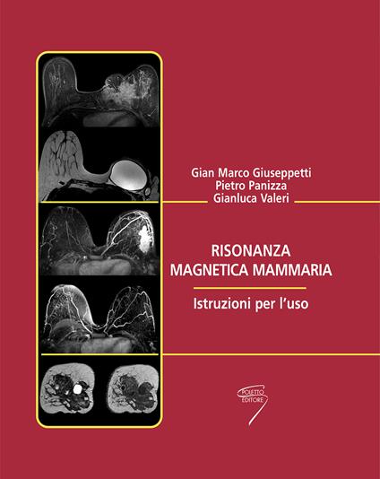 Risonanza magnetica mammaria. Istruzioni per l'uso - copertina