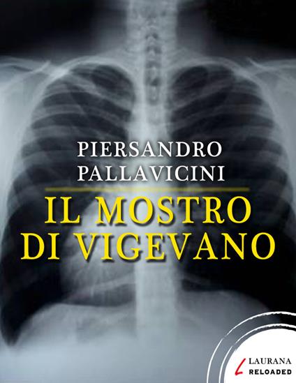 Il mostro di Vigevano - Piersandro Pallavicini - ebook