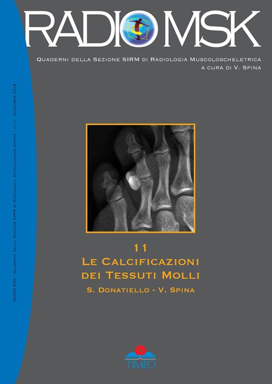 Le calcificazioni dei tessuti molli. Ediz. illustrata - Salvatore Donatiello,Vincenzo Spina - copertina