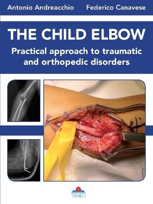 The child elbow. Practical approach to traumatic and orthopedic disorders - Antonio Andreacchio,Federico Canavese - copertina