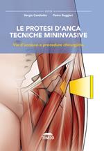 Le protesi d’anca. Tecniche mininvasive. Vie d’accesso e procedure chirurgiche. Ediz. illustrata