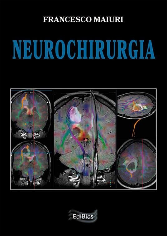 Neurochirurgia - Francesco Maiuri - copertina