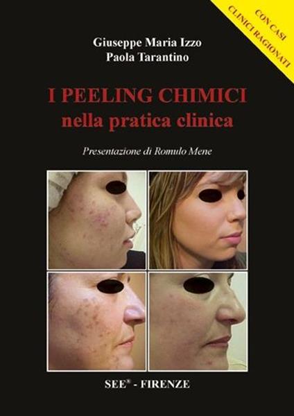 I peeling chimici nella pratica clinica - Giuseppe M. Izzo,Paola Tarantino - copertina