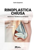 Rinoplastica chiusa. Manuale tecnico illustrato