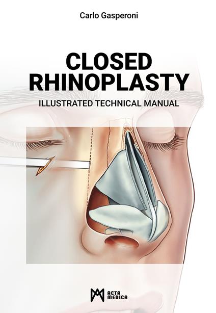 Closed rhinoplasty. Illustrated technical manual - Carlo Gasperoni - copertina