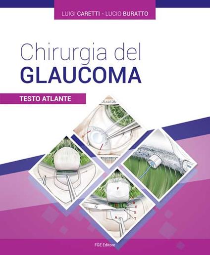 Chirurgia del glaucoma. Testo atlante - Luigi Caretti,Lucio Buratto - copertina