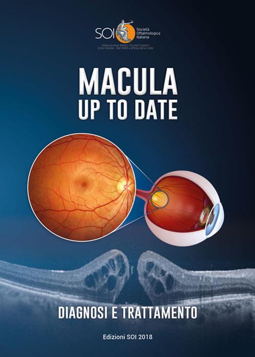 Macula up to date. Diagnosi e trattamento. Ediz. per la scuola - copertina