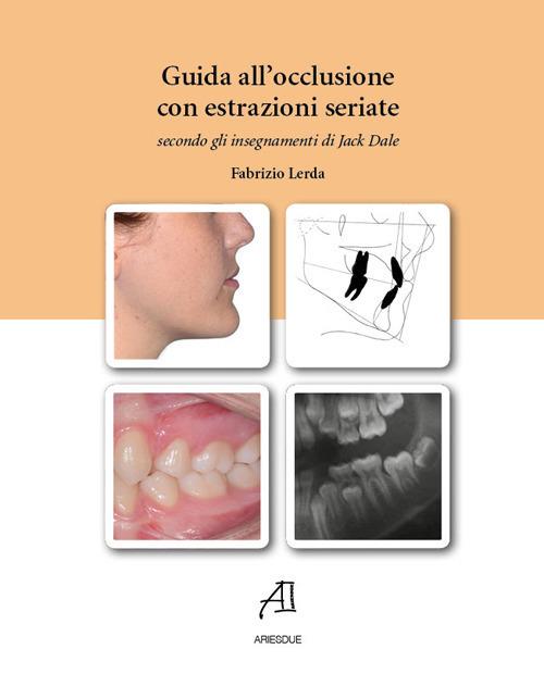 Guida all'occlusione con estrazioni seriate secondo gli insegnamenti di Jack Dale - Fabrizio Lerda - copertina