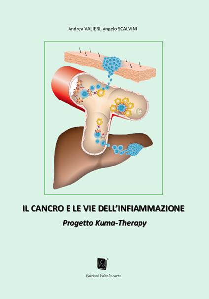 Il cancro e le vie dell'infiammazione. Progetto Kuma-Therapy - Andrea Valieri,Angelo Scalvini - copertina