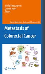 Metastasis of Colorectal Cancer