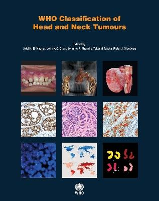 WHO classification of head and neck tumours - International Agency for Research on Cancer - cover