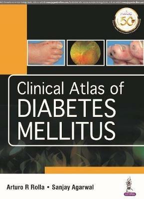 Clinical Atlas of Diabetes Mellitus - Arturo R Rolla,Sanjay Agarwal - cover