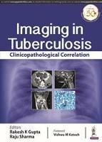 Imaging in Tuberculosis: Clinicopathological Correlation