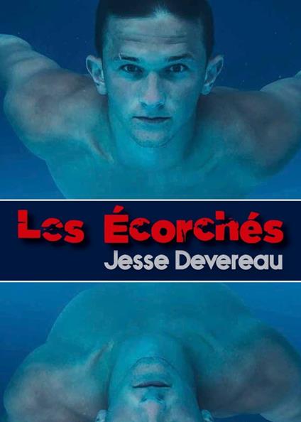 Les Écorchés