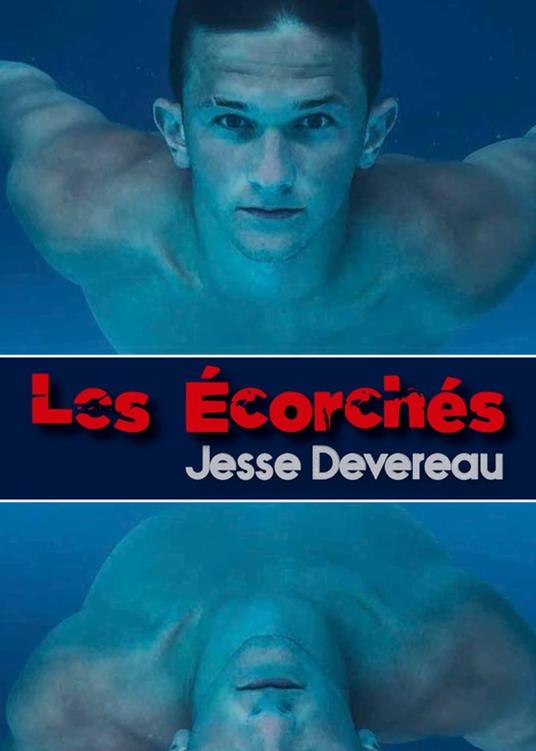 Les Écorchés