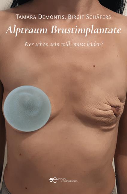 Alptraum Brustimplantate. Wer schön sein will, muss leiden? - Tamara Demontis,Birgit Schäfers - copertina