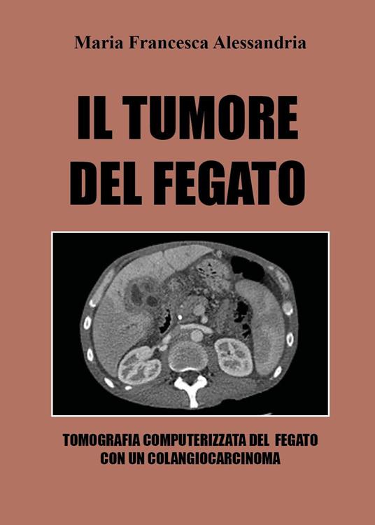 Il tumore del fegato - Maria Francesca Alessandria - Libro - Youcanprint -  | IBS