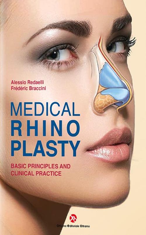 Medical rhinoplasty. Basic principles and clinical practice - Alessio Redaelli,Frederic Braccini - copertina