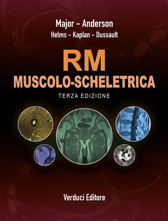 RM dell'apparato muscolo-scheletrico - Thomas H. Berquist - copertina